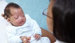 baby with cleft palate